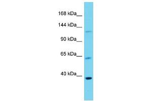 Host: Rabbit  Target Name: Dlg3  Sample Tissue: Mouse Lung lysates  Antibody Dilution: 1. (DLG3 anticorps  (Middle Region))
