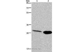 Western blot analysis of Human hepatocellular carcinoma and mouse skeletal muscle tissue, using CA3 Polyclonal Antibody at dilution of 1:200 (CA3 anticorps)