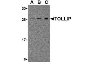 Western blot analysis of TOLLIP in Rat brain cell lysate with AP30928PU-N TOLLIP antibody at 0. (TOLLIP anticorps  (Center))
