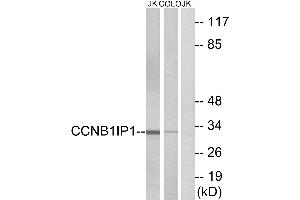 Western blot analysis of extracts from Jurkat cells and COLO cells, using CCNB1IP1 antibody. (CCNB1IP1 anticorps)