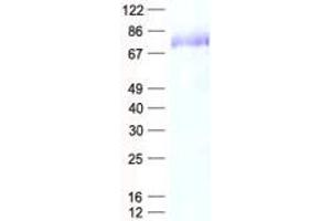 Validation with Western Blot (C1orf65 Protein (His tag))