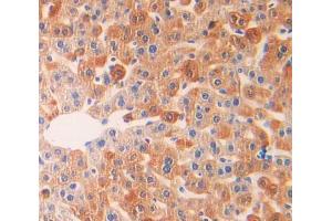 IHC-P analysis of liver tissue, with DAB staining. (IL18R1 anticorps  (AA 391-518))