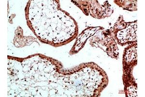 Immunohistochemical analysis of paraffin-embedded human-placenta, antibody was diluted at 1:200 (Ubiquitin B anticorps)
