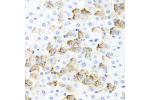 Immunohistochemistry of paraffin-embedded rat liver using F3 antibody at dilution of 1:100 (x40 lens). (Tissue factor anticorps)