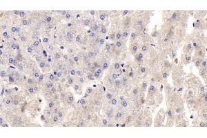 Detection of OPG in Human Liver Tissue using Polyclonal Antibody to Osteoprotegerin (OPG)
