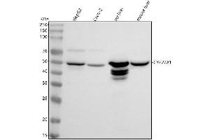 Western blot analysis of CYP27A1 using anti-CYP27A1 antibody (ABIN7604566).