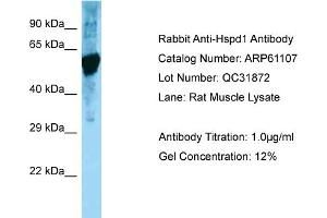 Western Blotting (WB) image for anti-Heat Shock 60kDa Protein 1 (Chaperonin) (HSPD1) (C-Term) antibody (ABIN970918) (HSPD1 anticorps  (C-Term))