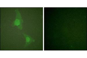 Immunofluorescence analysis of HeLa cells, using ADD1 (Ab-726) antibody. (alpha Adducin anticorps)