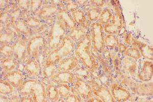Anti-CXCR3 Picoband antibody, IHC(P): Rat Kidney Tissue (CXCR3 anticorps  (AA 1-368))
