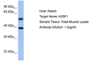WB Suggested Anti-A2BP1 Antibody Titration: 0. (A2BP1 anticorps  (N-Term))
