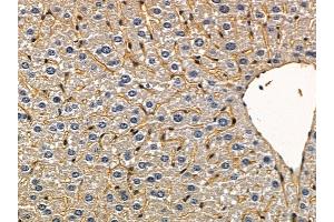 ABIN6258935 and ABIN6275451 at 1/100 staining mouse liver tissue by IHC-P. (G3BP2 anticorps  (C-Term))