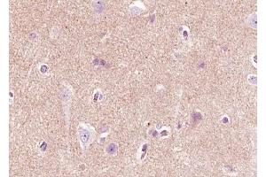 ABIN6268720 at 1/100 staining human brain tissue sections by IHC-P. (Nerve Growth Factor anticorps  (Internal Region))