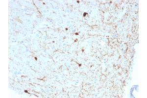 Formalin-fixed, paraffin-embedded human Cerebellum stained with Calretinin Mouse Monoclonal Antibody (CALB2/2786). (Calretinin anticorps  (AA 23-242))