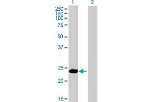 Western Blot analysis of PPP1R2P9 expression in transfected 293T cell line by PPP1R2P9 MaxPab polyclonal antibody. (PPP1R2P9 anticorps  (AA 1-202))