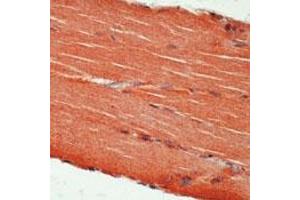 Formalin-fixed, paraffin-embedded human skeletal muscle stained with c-erbB3 Ab using peroxidase-conjugate and AEC chromogen. (ERBB3 anticorps)