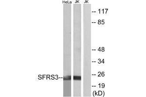 Western blot analysis of extracts from HeLa cells and Jurkat cells, using SFRS3 antibody. (SRSF3 anticorps  (C-Term))