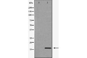 Western blot analysis of extracts of NCI-H460, using CST3 antibody. (CST3 anticorps)