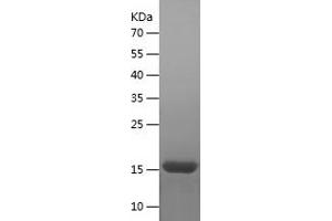 Fibroblast Growth Factor 1 (Acidic) (FGF1) (AA 16-155) protein (His tag)