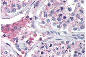 Human Testis: Formalin-Fixed, Paraffin-Embedded (FFPE)