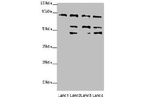 Western blot analysis of (1) HeLa whole cell lysates, (2) 293T whole cell lysates, (3) Mouse liver tissue, and (4) Mouse kidney tissue, using ZFYVE1 antibody (6. (ZFYVE1 anticorps  (AA 1-280))