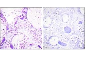 Immunohistochemistry analysis of paraffin-embedded human placenta tissue, using PPAR-gamma (Ab-112) Antibody.