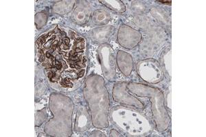 Immunohistochemical staining (Formalin-fixed paraffin-embedded sections) of human kidney with LAMA5 monoclonal antibody, clone CL3118  shows strong immunoreactivity in basement membrane of renal tubules and membranous positivity in glomeruli. (Laminin alpha 5 anticorps)