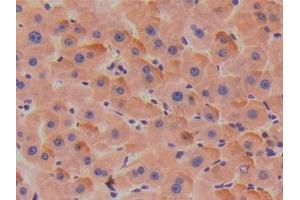 Detection of TBG in Human Liver Tissue using Polyclonal Antibody to Thyroxine Binding Globulin (TBG)