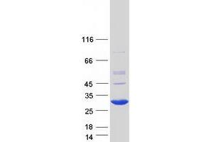 Validation with Western Blot