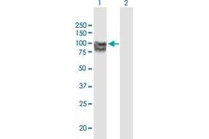 Western Blot analysis of OPA1 expression in transfected 293T cell line by OPA1 monoclonal antibody (M02), clone 8A20. (OPA1 anticorps  (AA 851-960))