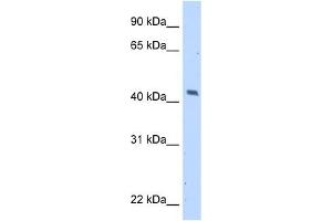 MAGEA1 antibody used at 5 ug/ml to detect target protein. (MAGEA1 anticorps)