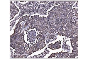 IHC analysis of FABP-1/GOT2 using anti-FABP-1/GOT2 antibody (ABIN7601426). (GOT2 anticorps  (AA 35-430))