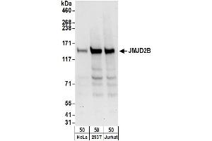Western Blotting (WB) image for anti-Lysine (K)-Specific Demethylase 4B (KDM4B) (AA 1056-1096) antibody (ABIN7451825) (KDM4B anticorps  (AA 1056-1096))