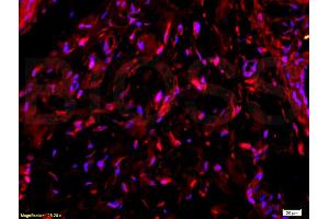 anti-Collagen, Type V (COL5) (AA 1450-1500) antibody