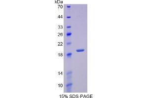 SDS-PAGE of Protein Standard from the Kit (Highly purified E. (REG3g Kit ELISA)