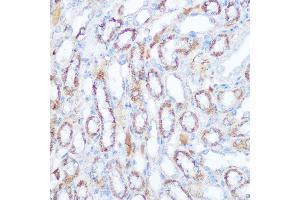 Immunohistochemistry of paraffin-embedded mouse kidney using SIRT4 Rabbit pAb (ABIN6129330, ABIN6147796, ABIN6147797 and ABIN6223494) at dilution of 1:100 (40x lens).