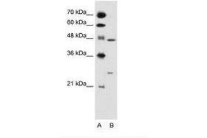 Image no. 1 for anti-Retinoid X Receptor, gamma (RXRG) (AA 101-150) antibody (ABIN6736682) (Retinoid X Receptor gamma anticorps  (AA 101-150))