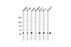 All lanes : Anti-DCLRE1C Antibody (N-term) at 1:2000 dilution Lane 1: HepG2 whole cell lysate Lane 2: HT-29 whole cell lysate Lane 3: Jurkat whole cell lysate Lane 4: mouse heart lysate Lane 5: MCF-7 whole cell lysate Lane 5: PC-3 whole cell lysate Lane 5: ZR-75-1 whole cell lysate Lysates/proteins at 20 μg per lane. (DCLRE1C anticorps  (N-Term))