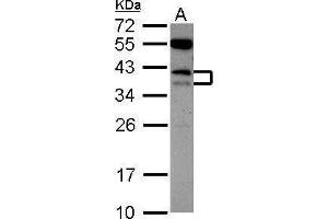 WB Image Sample (30 ug of whole cell lysate) A: K562 12% SDS PAGE antibody diluted at 1:1000 (CD79b anticorps  (Center))