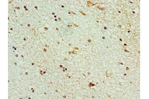 Immunohistochemistry of paraffin-embedded human brain tissue using ABIN7168991 at dilution of 1:100 (STK32A anticorps  (AA 1-166))