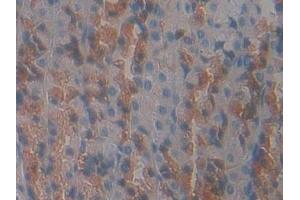 Detection of GHR in Rat Stomach Tissue using Polyclonal Antibody to Growth Hormone Receptor (GHR)