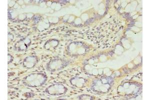 Immunohistochemistry of paraffin-embedded human small intestine tissue using ABIN7146249 at dilution of 1:100 (CPED1 anticorps  (AA 221-472))