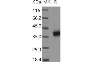 Western Blotting (WB) image for Cell Adhesion Molecule 3 (CADM3) protein (His tag) (ABIN7321187)