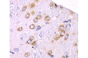 Immunohistochemistry of paraffin-embedded Rat brain using RPS3A Polyclonal Antibody at dilution of 1:100 (40x lens). (RPS3A anticorps)