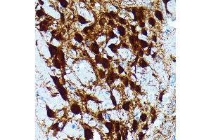 Immunohistochemistry of paraffin-embedded mouse brain using Parvalbumin (PVALB) (PVALB) Rabbit mAb (ABIN7269182) at dilution of 1:100 (40x lens).