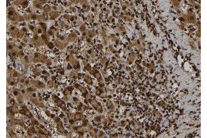 ABIN6277753 at 1/100 staining Human liver tissue by IHC-P. (PYDC1 anticorps)