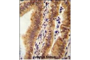 KI Antibody (C-term) (ABIN654471 and ABIN2844205) immunohistochemistry analysis in formalin fixed and paraffin embedded human uterus tissue followed by peroxidase conjugation of the secondary antibody and DAB staining.