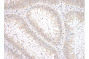 Immunohistochemistry (IHC) image for anti-tyrosyl-DNA phosphodiesterase 2 (TDP2) (AA 50-100) antibody (ABIN7453801)