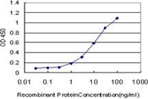 Detection limit for recombinant GST tagged ERN1 is approximately 0. (ERN1 anticorps  (AA 401-500))