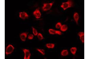 ABIN6266569 staining HepG2 by IF/ICC. (KRT16 anticorps  (C-Term))