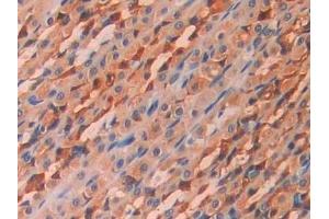 Detection of CA12 in Rat Stomach Tissue using Polyclonal Antibody to Carbonic Anhydrase XII (CA12)